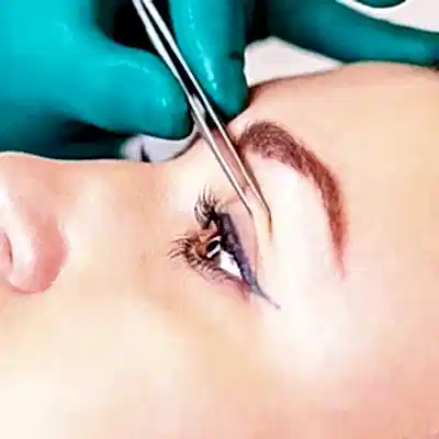 GÖZ KAPAĞI ESTETİĞİ 